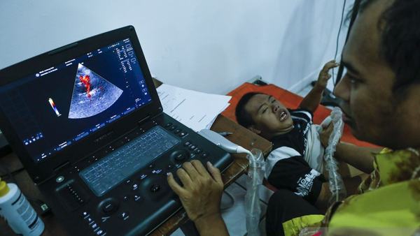 Penyakit rematik jantung bisa sebabkan kebocoran katup jantung